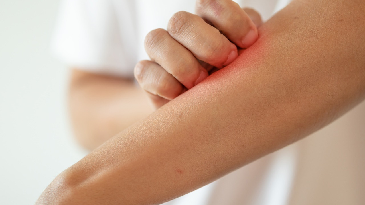 Nietolerancja pokarmowa a alergia – jak je odróżnić?