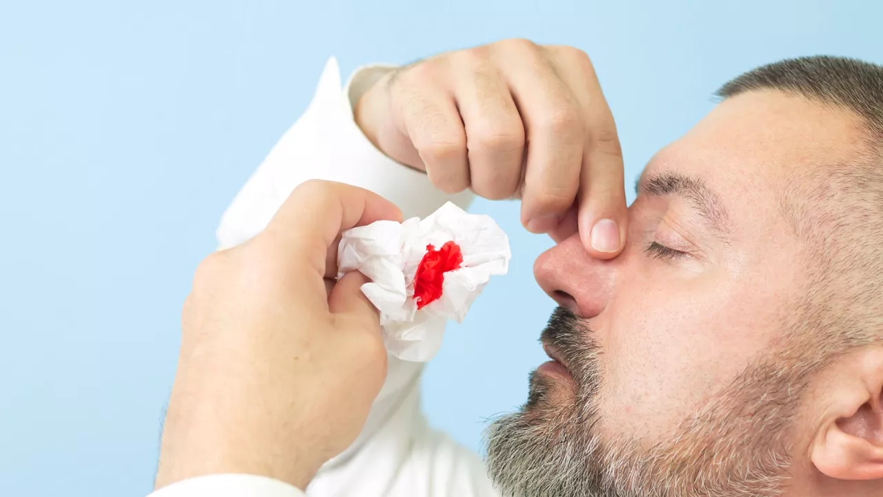 Jak zatamować krwotok z nosa? Poznaj jego przyczyny